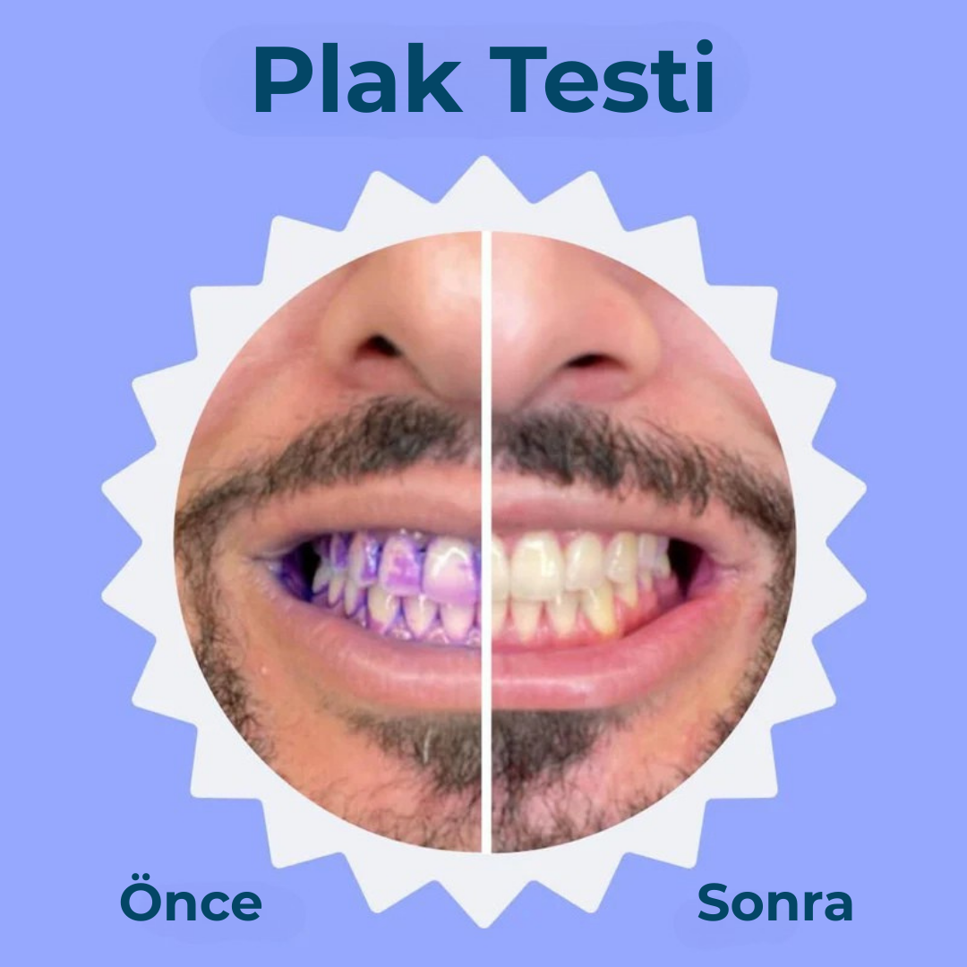 Prosmile