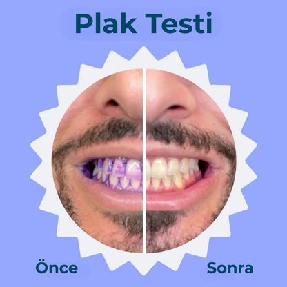 Prosmile